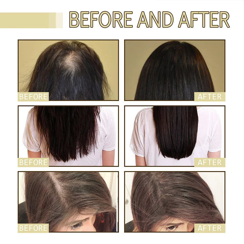 Rosemary Hair Essential Oil